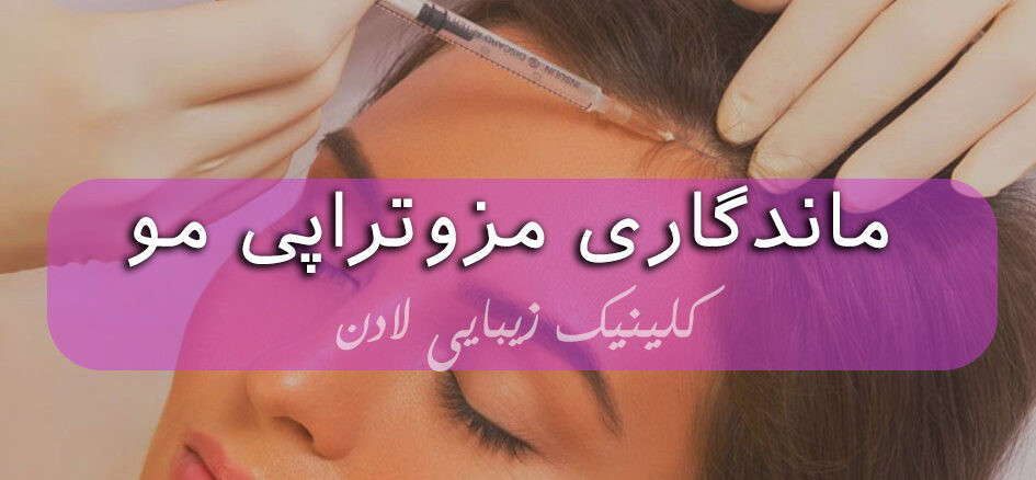 ماندگاری مزوتراپی مو