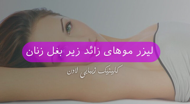 لیزر موهای زائد زیر بغل زنان