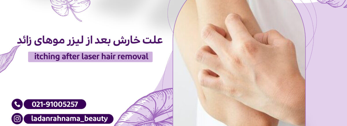 دلایل خارش بعد از لیزر موهای زائد چیست؟ | مرکز زیبایی لادن