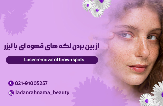 چگونه لک های قهوه ای جای جوش را با لیزر از بین ببریم؟ - مرکز زیبایی لادن