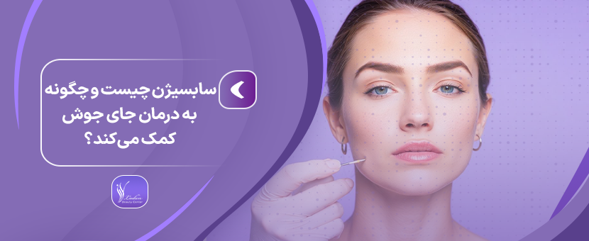 سابسیژن چیست و چگونه به درمان جای جوش کمک می‌کند؟