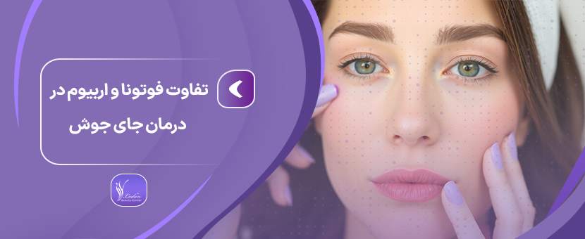 تفاوت فوتونا و اربیوم در درمان جای جوش | کدام بهتر است؟