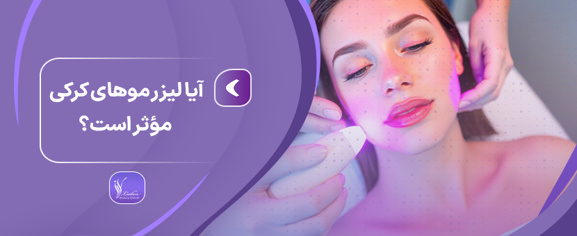آیا لیزر موهای کرکی مؤثر است؟ | از بین بردن موهای کرکی با کیوسوئیچ هلیوس 3
