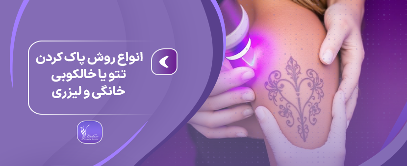 انواع روش پاک کردن تتو یا خالکوبی خانگی و لیزری
