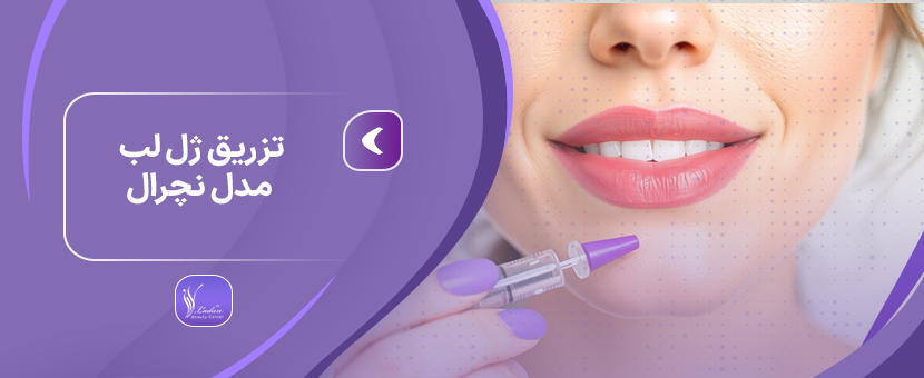 تزریق ژل لب مدل نچرال - مرکز زیبایی لادن