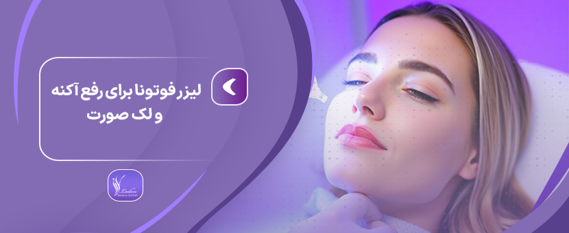 لیزر فوتونا برای رفع آکنه و لک صورت-مرکز زیبایی لادن