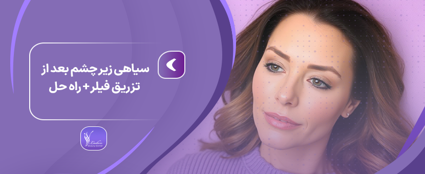 سیاهی زیر چشم بعد از تزریق فیلر + راه حل - مرکز زیبایی لادن
