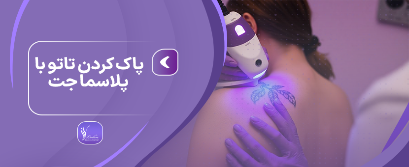 پاک کردن تاتو با پلاسما جت - مرکز زیبایی لادن