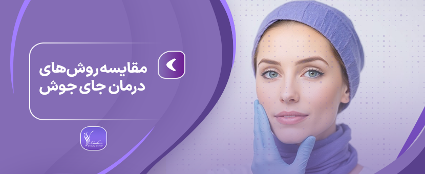 مقایسه روش‌های درمان جای جوش: لیزر، میکرونیدلینگ و سابسیژن