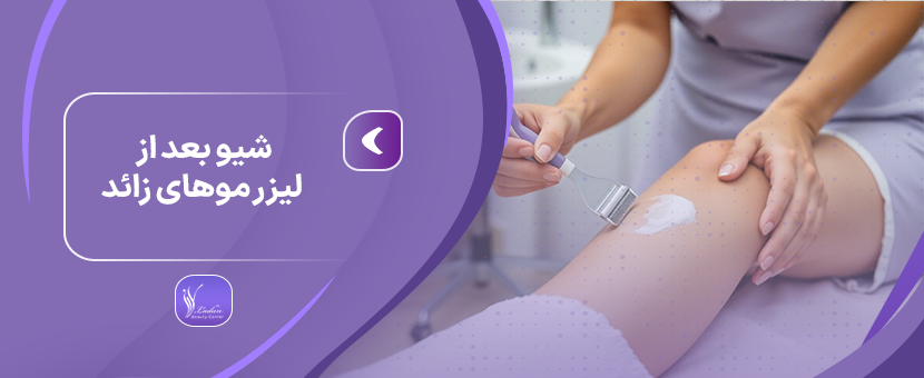 شیو بعد از لیزر | چند وقت بعد از لیزر شیو کنیم؟-مرکز زیبایی لادن
