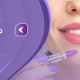 تزریق ژل لب مدل نچرال - مرکز زیبایی لادن