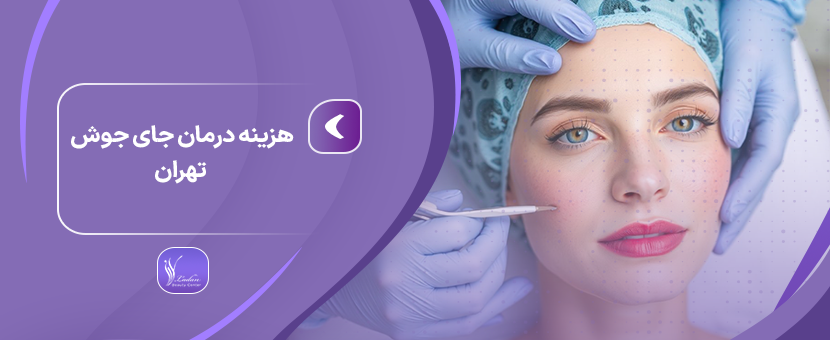 هزینه درمان جای جوش در تهران: روش‌ها و عوامل مؤثر