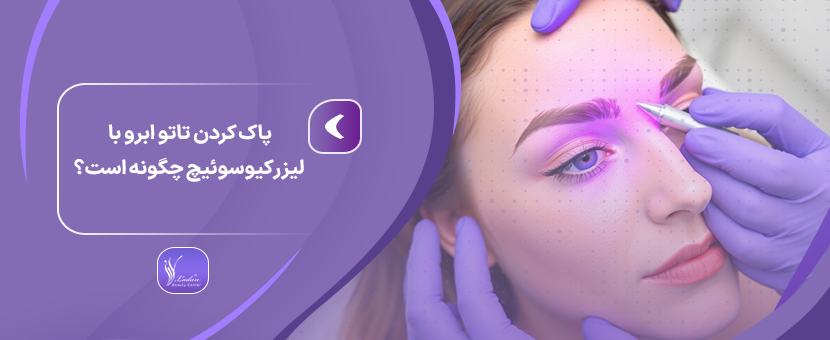 پاک كردن تاتو ابرو با ليزر كيوسوئيچ چگونه است؟